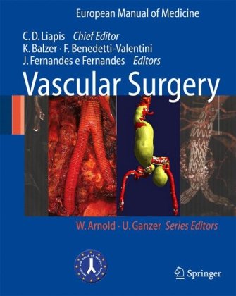 [PDF] Vascular Interventional Radiology Angioplasty, Stenting, Thrombolysis and Thrombectomy Christos D. Liapis, Klaus Balzer, Fabrizio Benedetti-Valentini, Jose Fernandes e Fernandes