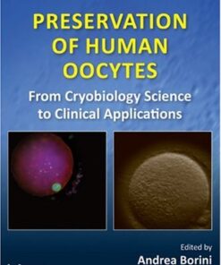 {PDF} Preservation of Human Oocytes (Reproductive Medicine and Assisted Reproductive Techniques) Andrea Borini, Giovanni Coticchio