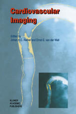 [PDF] Cardiovascular Imaging Simon H. Stertzer, Eugene V. Pomerantsev, Jonas A. Metz, Peter J. Fitzgerald (auth.), Johan H. C. Reiber, Ernst E. van der Wall (eds.)