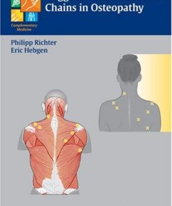 {PDF} Trigger points and muscle chains in osteopathy Richter P., Hebgen E.