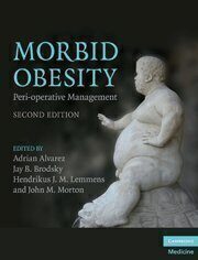 [PDF] Morbid Obesity: Peri-operative Management Adrian Alvarez, Jay B. Brodsky, Hendrikus J. M. Lemmens, John M. Morton