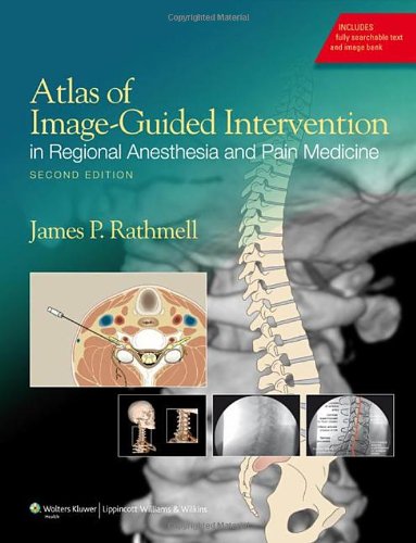 [PDF] Atlas of Image-Guided Intervention in Regional Anesthesia and Pain Medicine James P. Rathmell MD