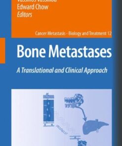 {PDF} Bone metastases: a translational and clinical approach Vassiliki Tzelepi, Athanassios C. Tsamandas, Vassiliki Zolota, Chrisoula D. Scopa (auth.), Dr. Dimitrios Kardamakis MD, PhD, DMRT, Dr. Vassilios Vassiliou MD, PhD, Dr. Edward Chow MBBS, PhD, FRCPC (eds.)