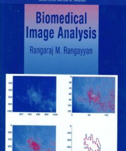 {PDF} Biomedical Image Analysis Rangaraj M. Rangayyan