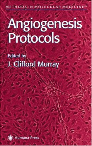 [PDF] Angiogenesis Protocols (Methods in Molecular Medicine) J. Clifford Murray