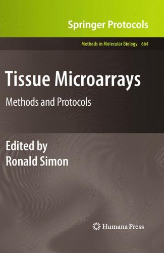 {pdf} Tissue Microarrays: Methods and Protocols Ronald Simon (auth.), Ronald Simon (eds.)