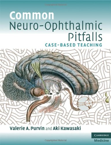 {PDF} Common Neuro-Ophthalmic Pitfalls: Case-Based Teaching Dr Valerie A. Purvin, Dr Aki Kawasaki