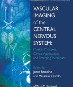 {pdf} Vascular Imaging of the Central Nervous System: Physical Principles, Clinical Applications and Emerging Techniques Joana Ramalho, Mauricio Castillo