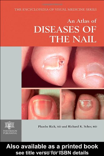 [PDF] An Atlas of Diseases of the Nail (Encyclopedia of Visual Medicine Series) Phoebe Rich, Richard K. Scher