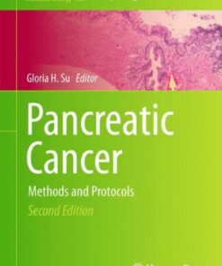 {pdf} Pancreatic Cancer: Methods and Protocols Hanno Matthaei, Marco Dal Molin, Anirban Maitra (auth.), Gloria H. Su (eds.)