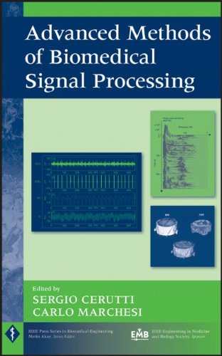 [PDF] Advanced Methods of Biomedical Signal Processing (IEEE Press Series on Biomedical Engineering) Sergio Cerutti, Carlo Marchesi