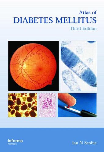 {PDF} Atlas of Diabetes Mellitus Ian N. Scobie