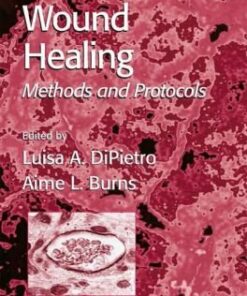 {PDF} Wound Healing: Methods and Protocols (Methods in Molecular Medicine) Luisa A. DiPietro, Aime L. Burns