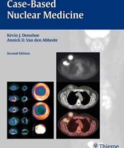 [PDF] Case-based Nuclear Medicine Van den Abbeele, Annick; Donohoe, Kevin J