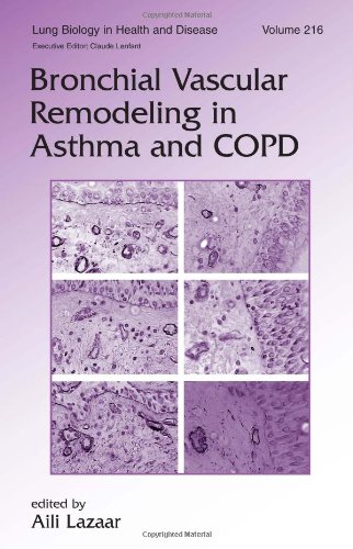 [PDF] Bronchial Vascular Remodeling in Asthma and COPD (Lung Biology in Health and Disease Vol 216) Aili Lazaar