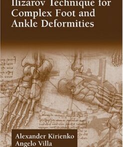 [PDF] Alexander Kirienko Ilizarov Technique for Complex Foot and Ankle Deformities Alexander Kirienko, Angelo Villa, Jason H. Calhoun