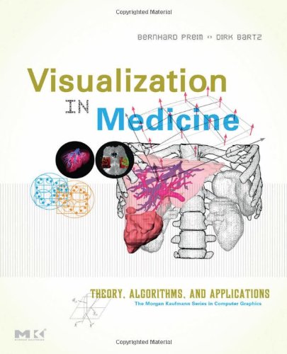 [PDF] Visualization in medicine. Theory, algorithms, and applications Bernhard Preim