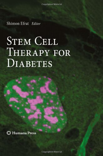 {pdf} Stem Cell Therapy for Diabetes George K. Gittes, Krishna Prasadan, Sidhartha Tulachan (auth.), Shimon Efrat (eds.)