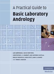 [PDF] A practical guide to basic laboratory andrology L Bjo?rndahl; et al