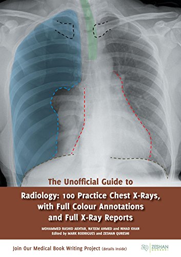 [PDF] The Unofficial Guide to Radiology coll.