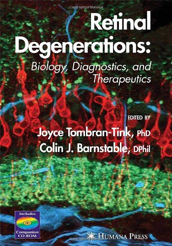 {pdf} Retinal Degenerations: Biology, Diagnostics and Therapeutics (Ophthalmology Research) Joyce, Ed. Tombran-Tink