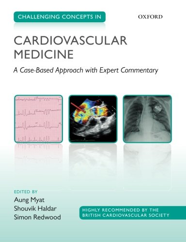 [PDF] Challenging Concepts in Cardiovascular Medicine: Cases with Expert Commentary Aung Myat, Shouvik Haldar, Simon Redwood
