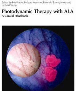 [PDF] Photodynamic Therapy with ALA: A Clinical Handbook Roy Pottier, Barbara Krammer, Herbert Stepp, Reinhold Baumgartner
