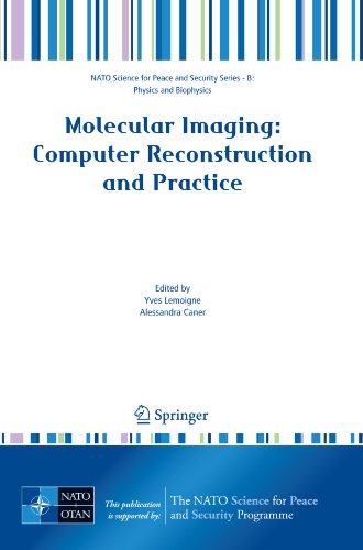 [pdf] Molecular Imaging: Computer Reconstruction and Practice (NATO Science for Peace and Security Series B: Physics and Biophysics) Yves Lemoigne, Alessandra Caner