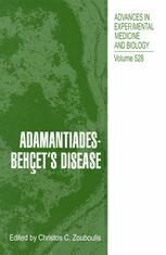 [PDF] Adamantiades-Beh?et?s Disease Kenneth T. Calamia, Eric L. Matteson (auth.), Christos C. Zouboulis (eds.)