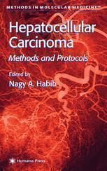 {PDF} Hepatocellular Carcinoma: Methods and Protocols Valery Usatoff, Nagy A. Habib (auth.), Nagy A. Habib (eds.)