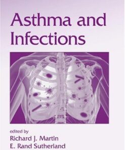 {pdf} Asthma and Infections, Volume 238 (Lung Biology in Health and Disease) Richard Martin, E. Rand Sutherland