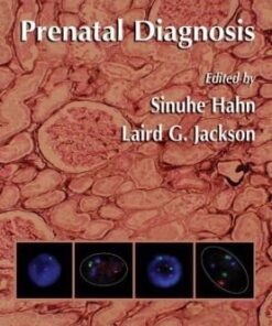 [PDF] Prenatal Diagnosis Susanne Mergenthaler-Gatfield, Wolfgang Holzgreve, Sinuhe Hahn (auth.), Sinuhe Hahn, Laird G. Jackson (eds.)