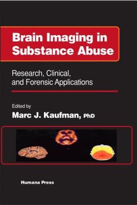 [PDF] Brain Imaging in Substance Abuse. Research, Clinical and Forensic Applns Marc J. Kaufman