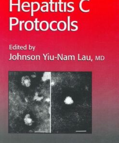 [PDF] Hepatitis C Protocols Johnson Y. N. Lau