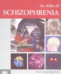 [PDF] Atlas of Schizophrenia Martin Stefan, Mike Travis, Robin Murray