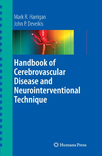 [PDF] Handbook of Cerebrovascular Disease and Neurointerventional Technique Mark R. Harrigan, John P. Deveikis (auth.)