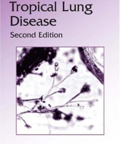 {pdf} Tropical Lung Disease,