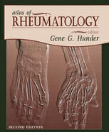 [PDF] Atlas of Rheumatology Eric L. Matteson (auth.), Gene G. Hunder MD (eds.)