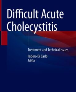 {PDF} Difficult Acute Cholecystitis: Treatment and Technical Issues Isidoro Di Carlo