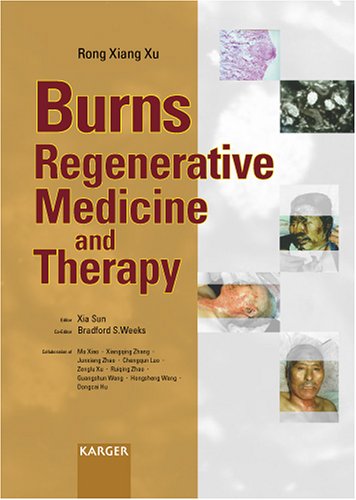 {PDF} Burns regenerative medicine and therapy Rong Xiang Xu, Xia Sun, Bradford S. Weeks