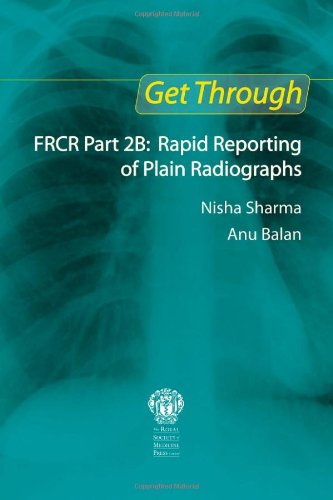 [PDF] Get through FRCR part 2B : rapid reporting of plain radiographs Sharma, Nisha; Balan, Anu