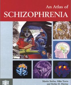[PDF] Atlas of Schizophrenia, Second Edition Martin Stefan, Mike Travis, Robin Murray