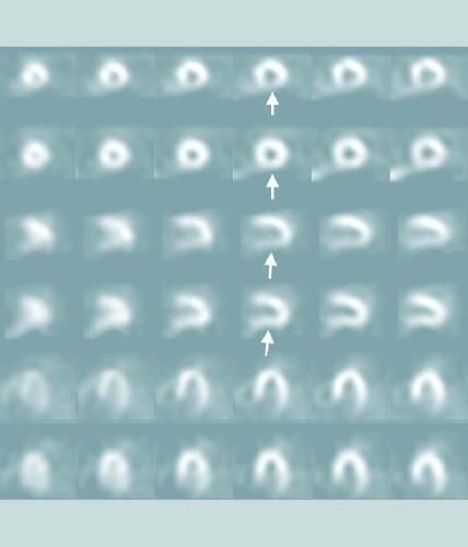 [PDF] Nuclear Medicine William D. Leslie, I. David Greenberg